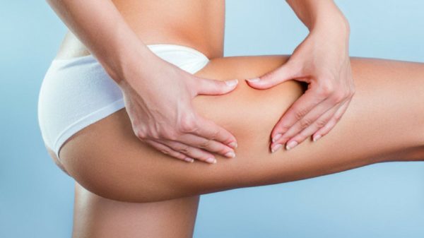 Combat cellulite: scientific remedies and the safety of creams
