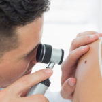 Skin tumors: how to recognize them, prevent them and treat them