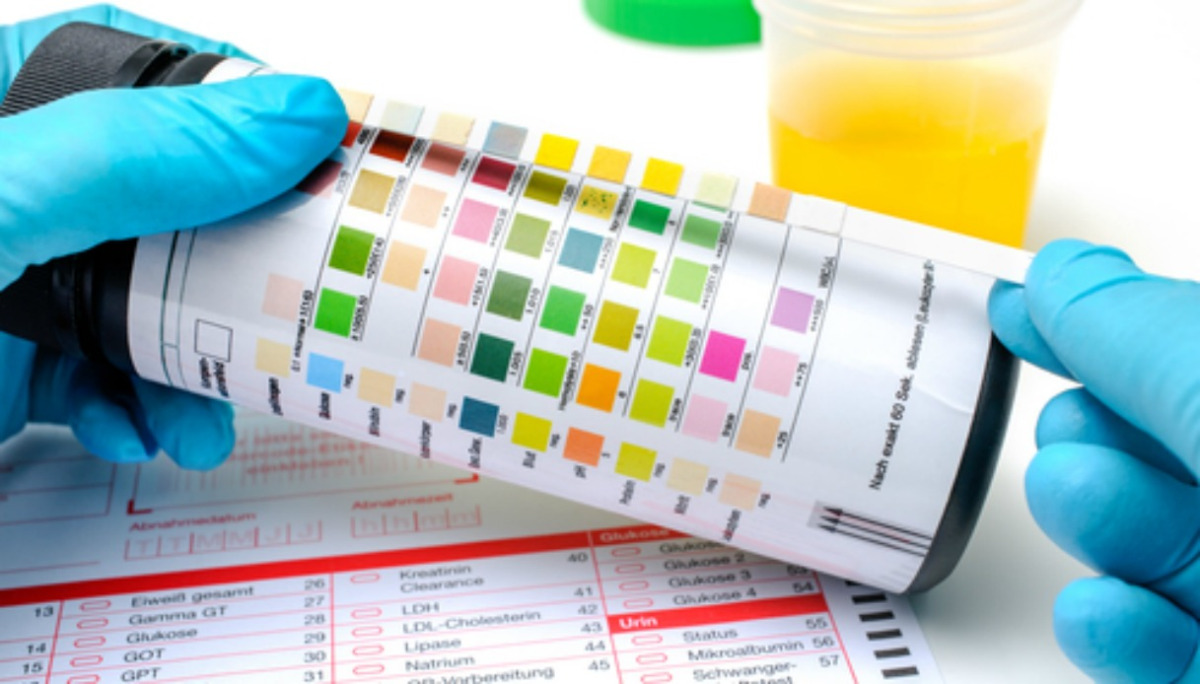 Can Urine Test Detect Early Pregnancy