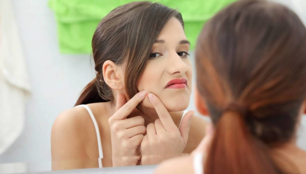 5-moves-to-eliminate-pimples-without-leaving-marks