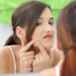 5 moves to eliminate pimples without leaving marks