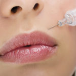 Botox, where to use it and how to get effective results