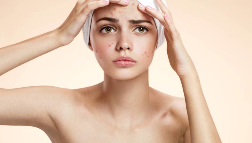 Pimples under the skin: causes and remedies