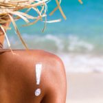 Sunburns: the most effective natural remedies