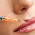 Botox against wrinkles: everything you need to know
