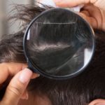 Head lice: how to recognize them and what to do to eliminate them
