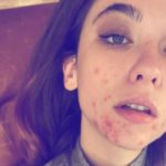 Matilda De Angelis su Instagram mostra il viso senza trucco: “Per accettarmi”