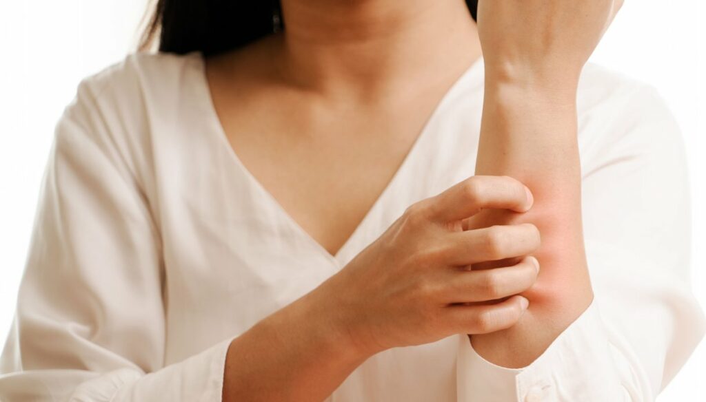 Urticaria: from symptoms to remedies, everything you need to know