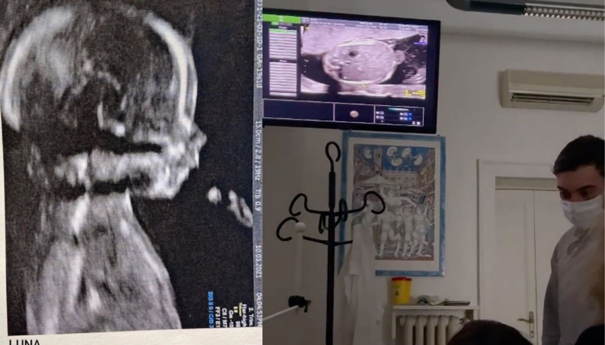 Belen Rodriguez ultrasound