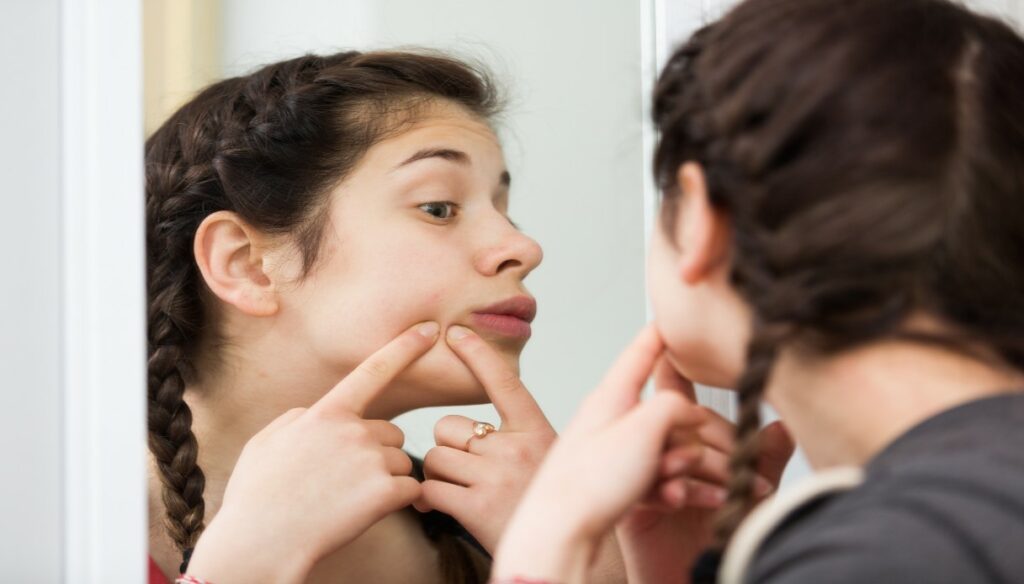 Juvenile acne: what to do?