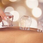 Cupping: what it is and what it is used for