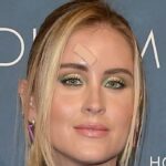 Valentina Ferragni shows the surgery scar: a life without filters