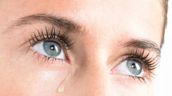 Blepharitis: what it is, what causes it and how to treat it