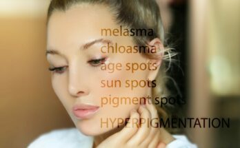 Spots on the face: types, causes, treatments and how to eliminate them permanently