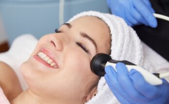 Facial radiofrequency: what it is, what it is for and what the benefits are