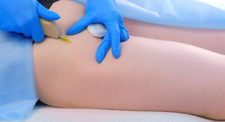 Carboxytherapy: what it is, how it works, benefits, when it is recommended