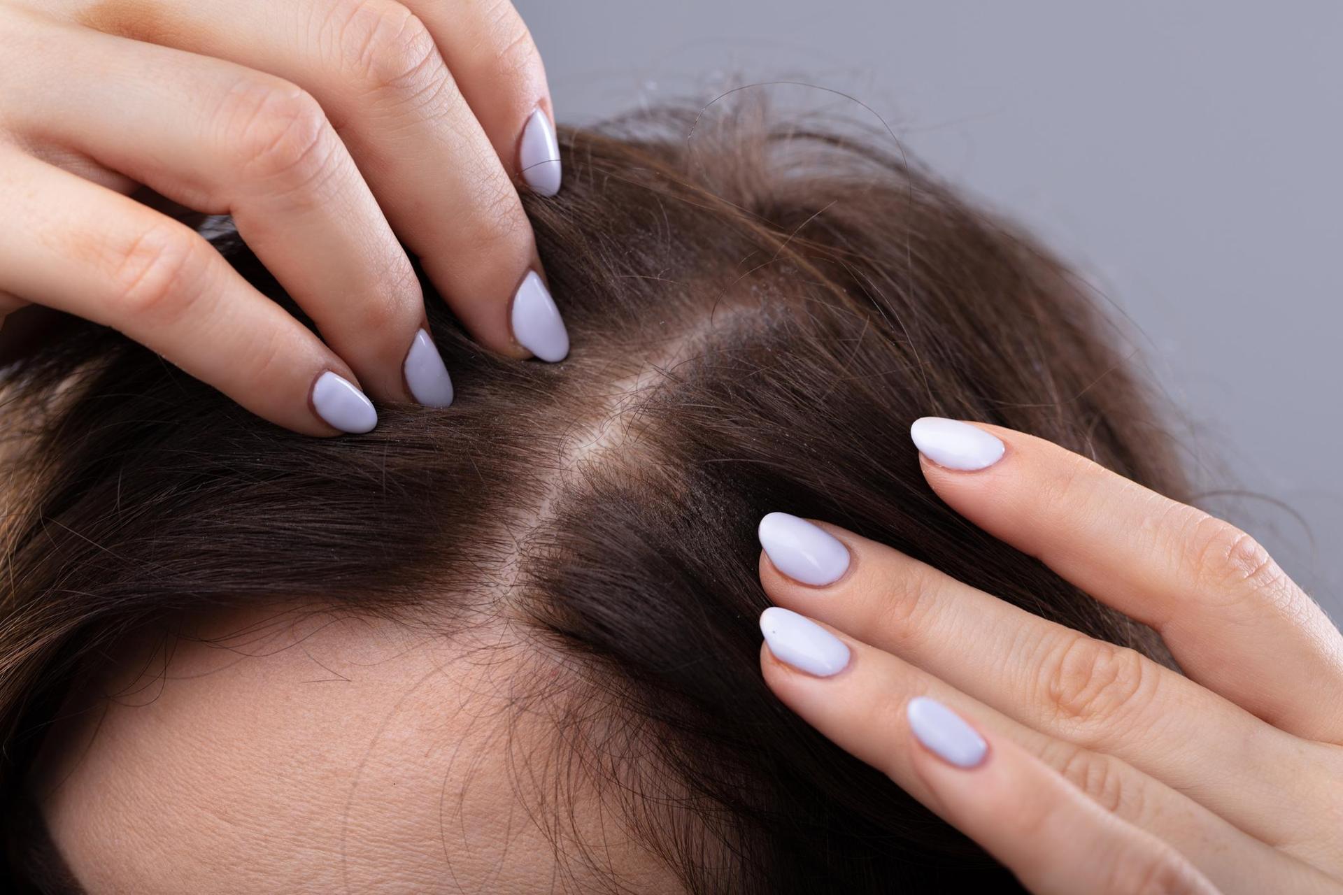 Massage into the scalp once a week.  A flood of new hair guaranteed