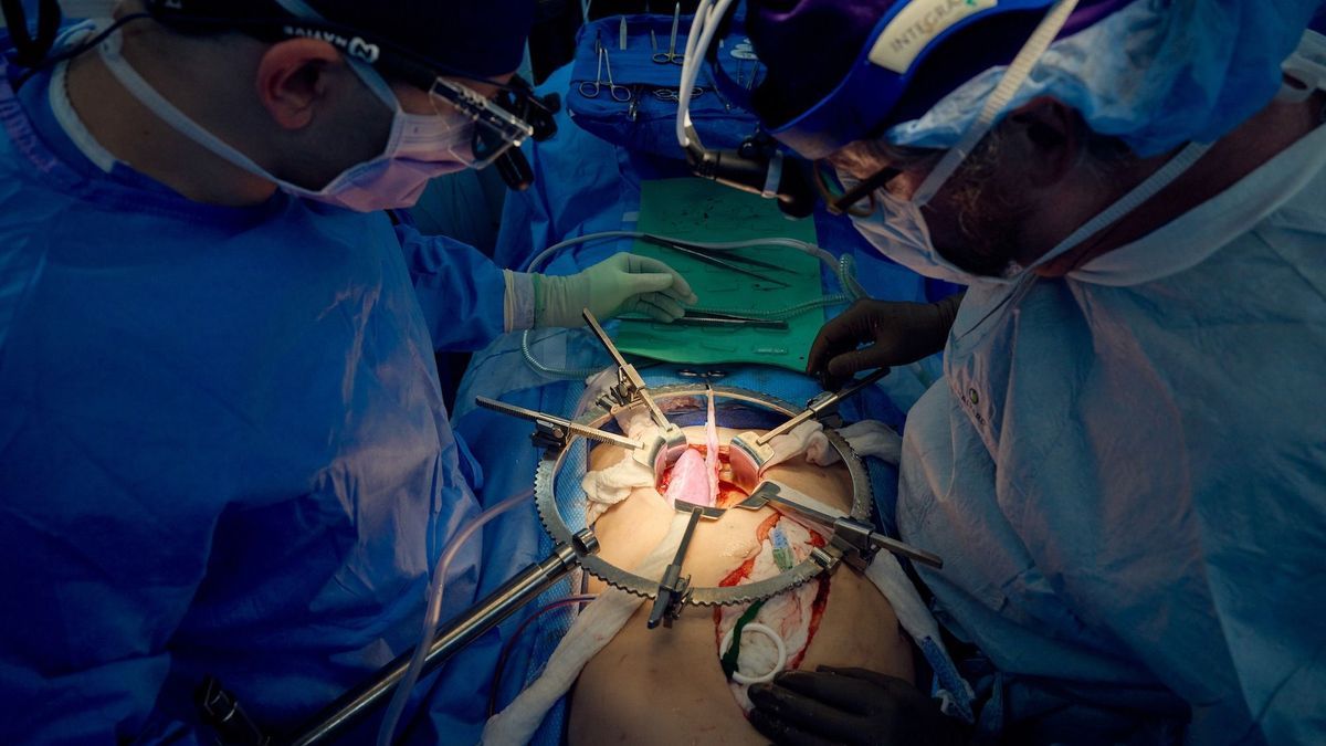 A pig kidney transplanted into a man continues to function after a month!