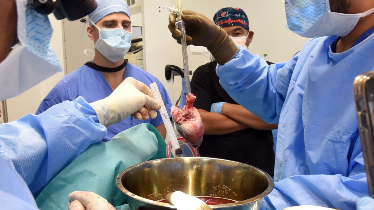 A pig heart transplanted into a human for the second time