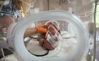 Artificial uterus: the United States' future project to save newborns