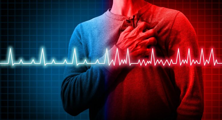 Atrial fibrillation: detecting cardiac arrhythmias with a smartphone