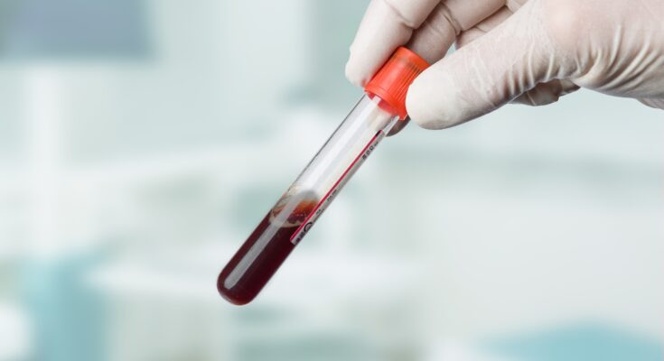New blood test detects Alzheimer's with very high accuracy