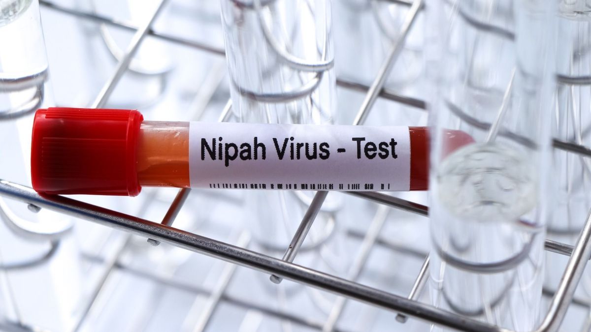 Nipah virus: could it be the cause of a new pandemic?