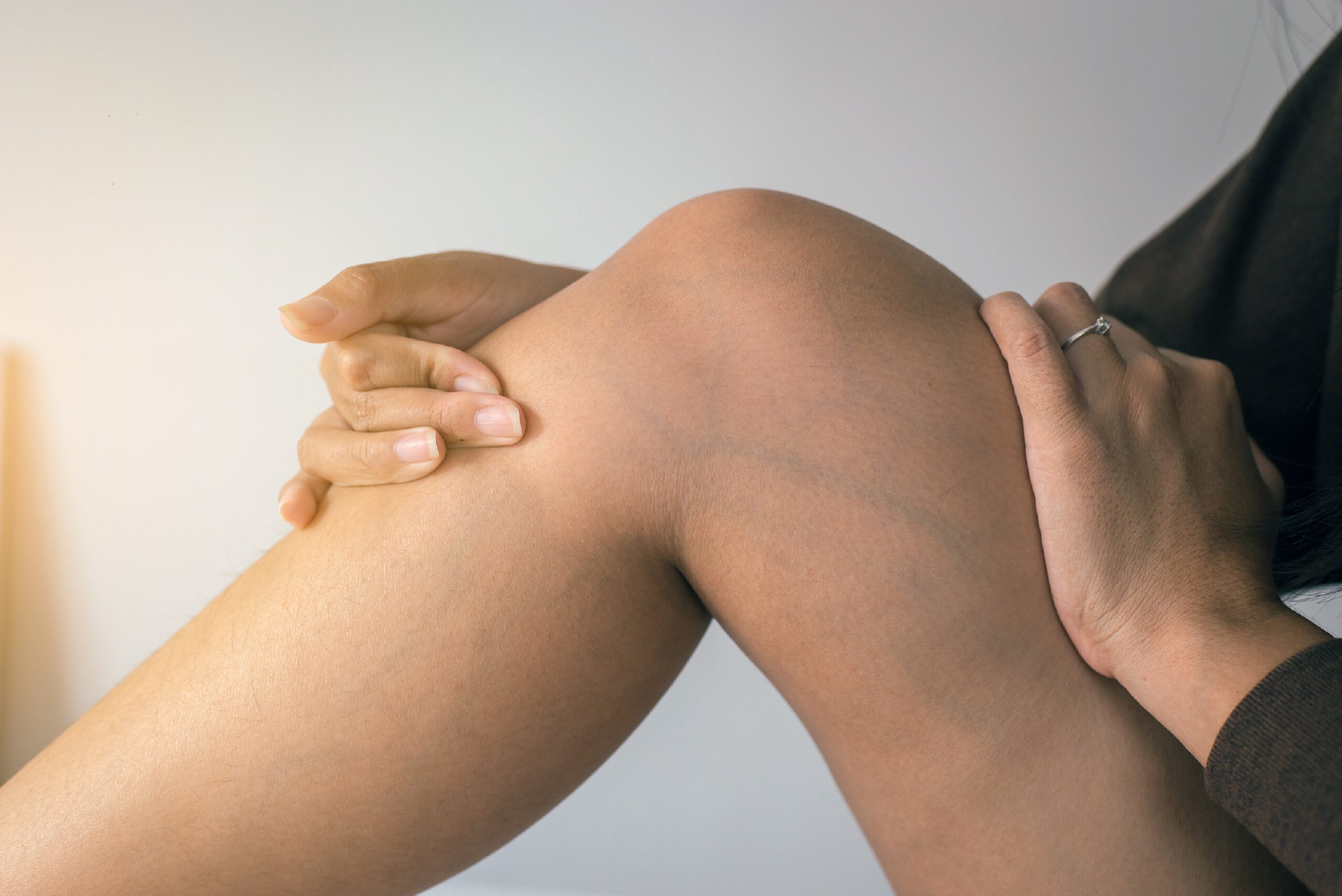 Varicose veins: which home remedies can really help