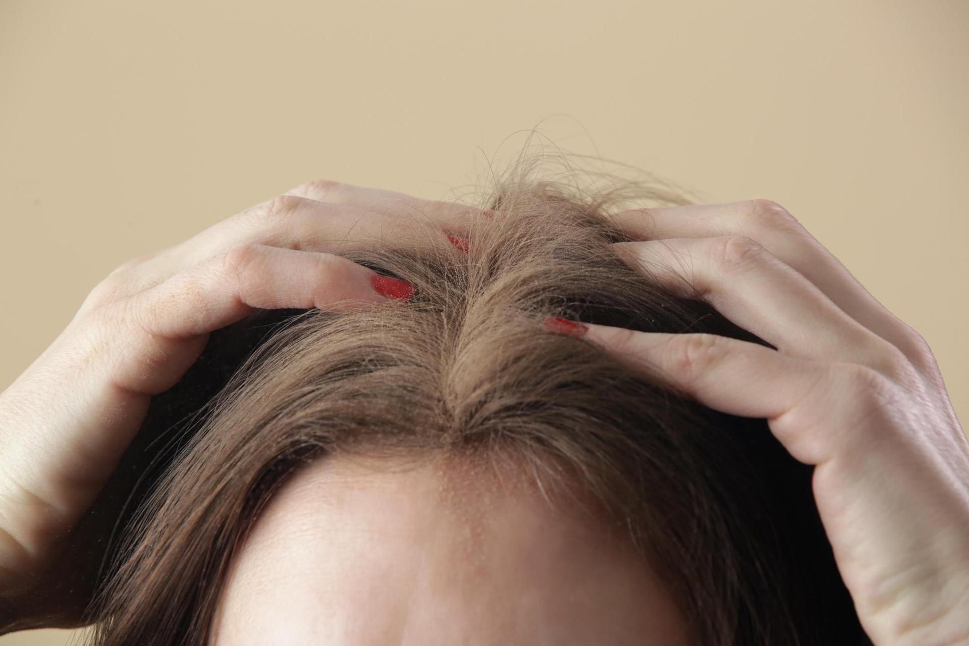 It costs PLN 6 and works better than dry shampoo.  How to refresh your hair, last minute version