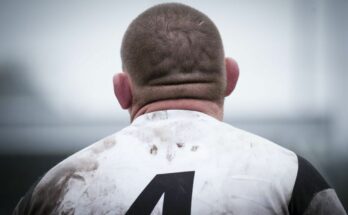 Why do rugby players have “cauliflower” ears?