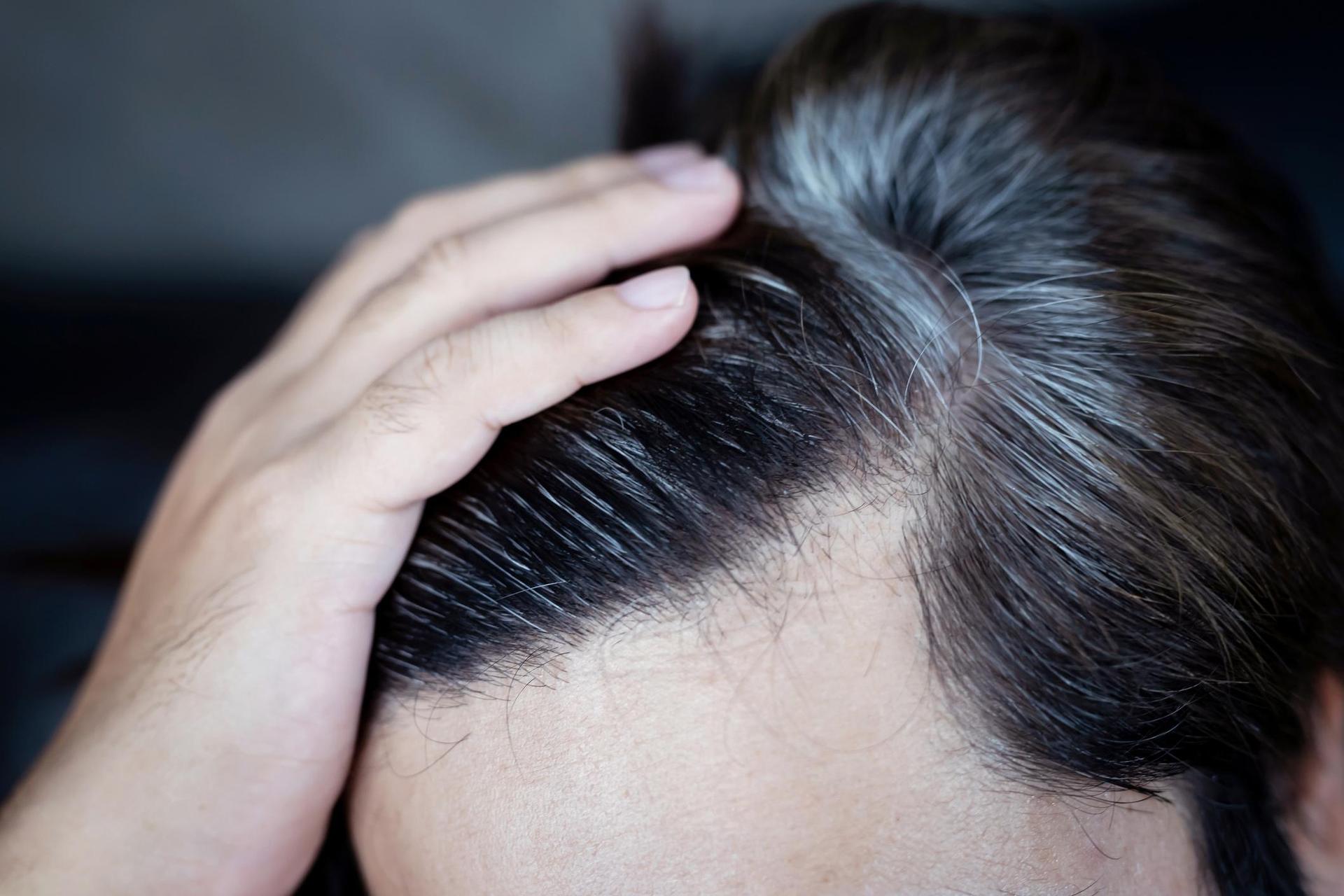 Apply onion to gray hair.  You will forget about expensive treatments at the hairdresser