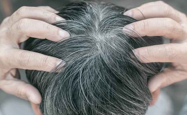 7 Causes of Gray Hair Appearing on the Head - Alodokter