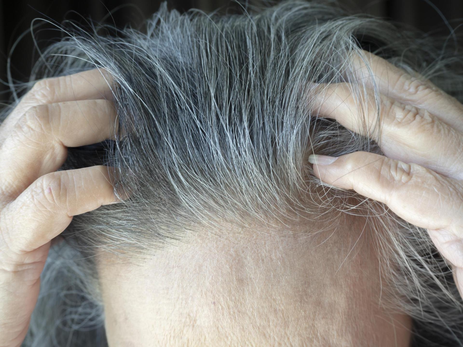 An effective way to get rid of gray hair for pennies.  Use it and you will forget about dyeing
