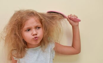 Do you know this disease that makes hair uncombable?