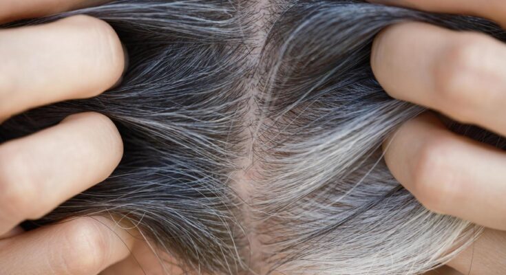 How to get rid of gray hair?  There are ways to do this without dyeing