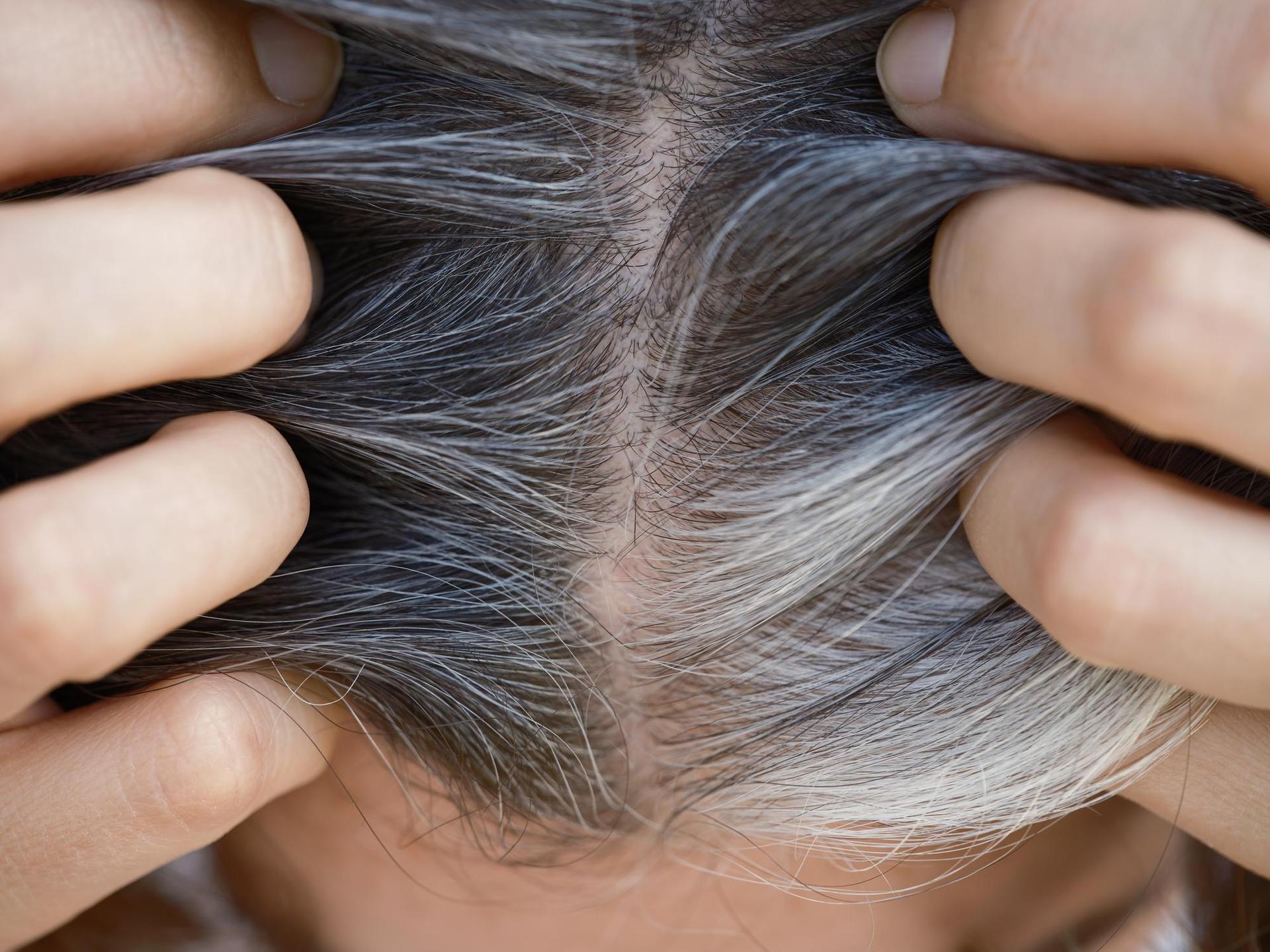 How to get rid of gray hair?  There are ways to do this without dyeing