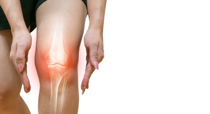 Coffee influences the risk of osteoarthritis