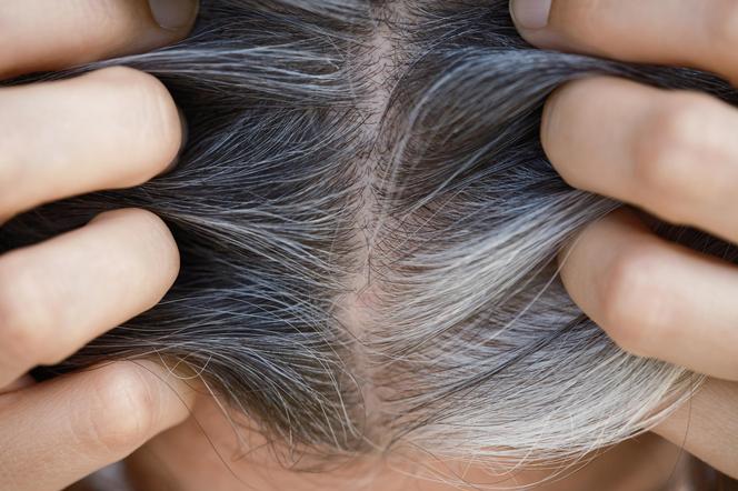 How to get rid of gray hair?  There are ways to do this without dyeing 