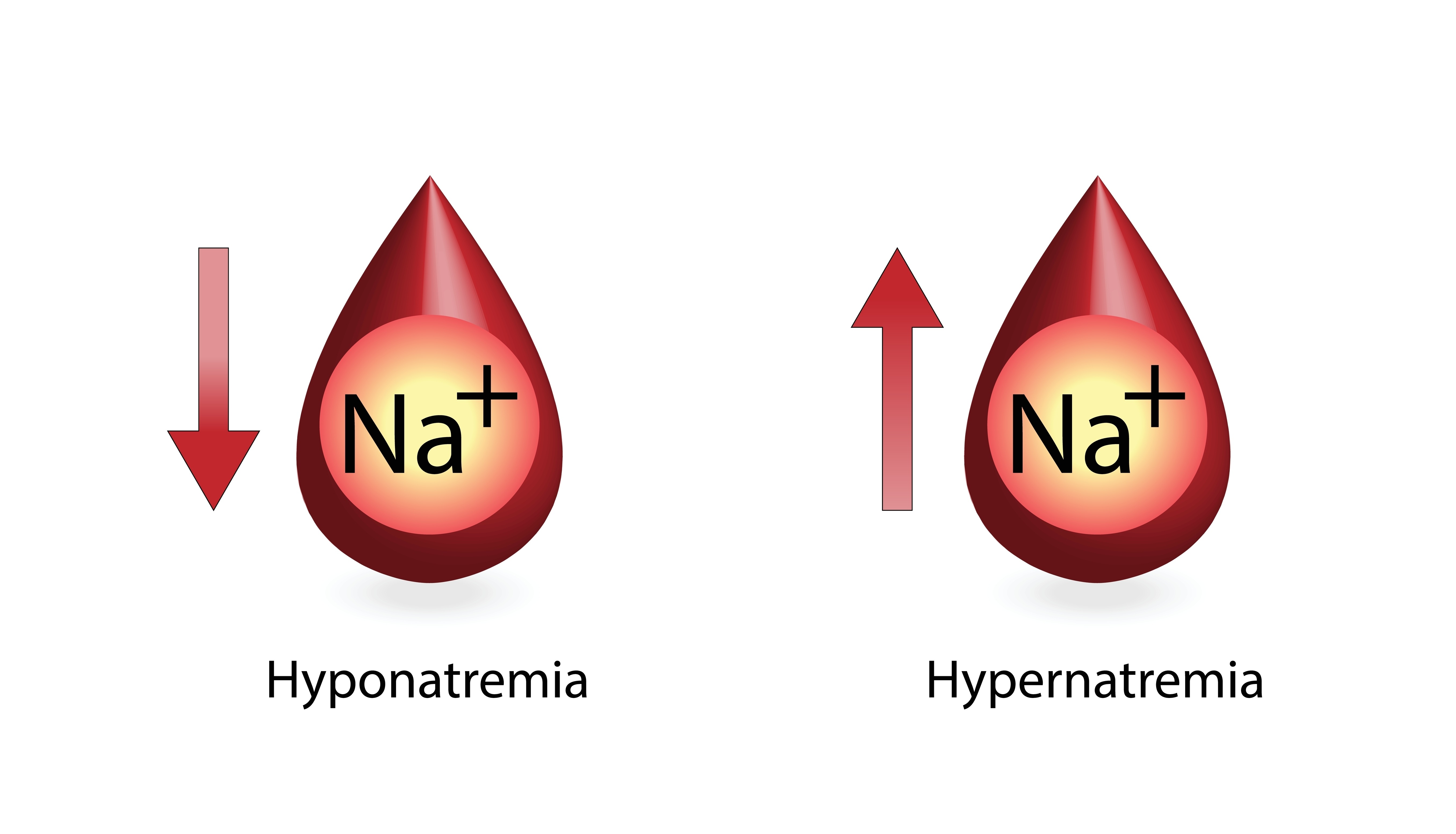 hypernatremia - hyponatremia
