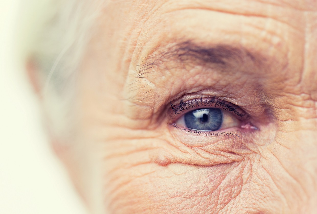 Skin microbiome can increase skin aging and wrinkles