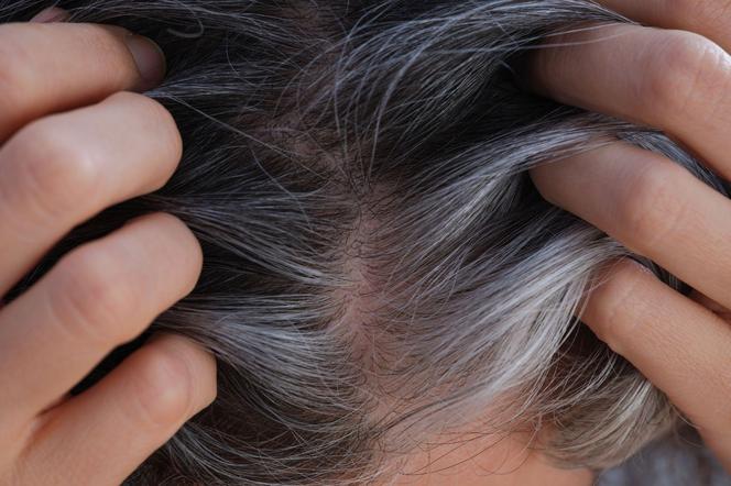 The best home remedy for gray hair.  Our grandmothers already knew him
