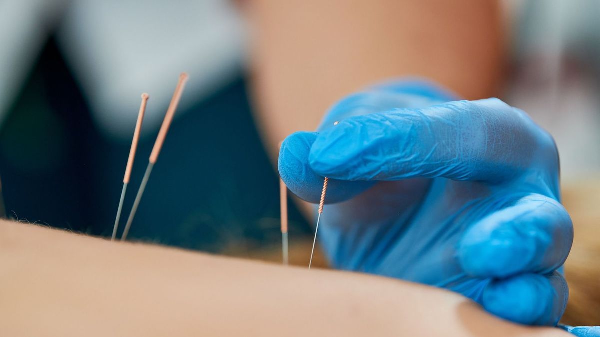 He believes he suffers from an aneurysm, doctors discover an acupuncture needle lodged in his brain