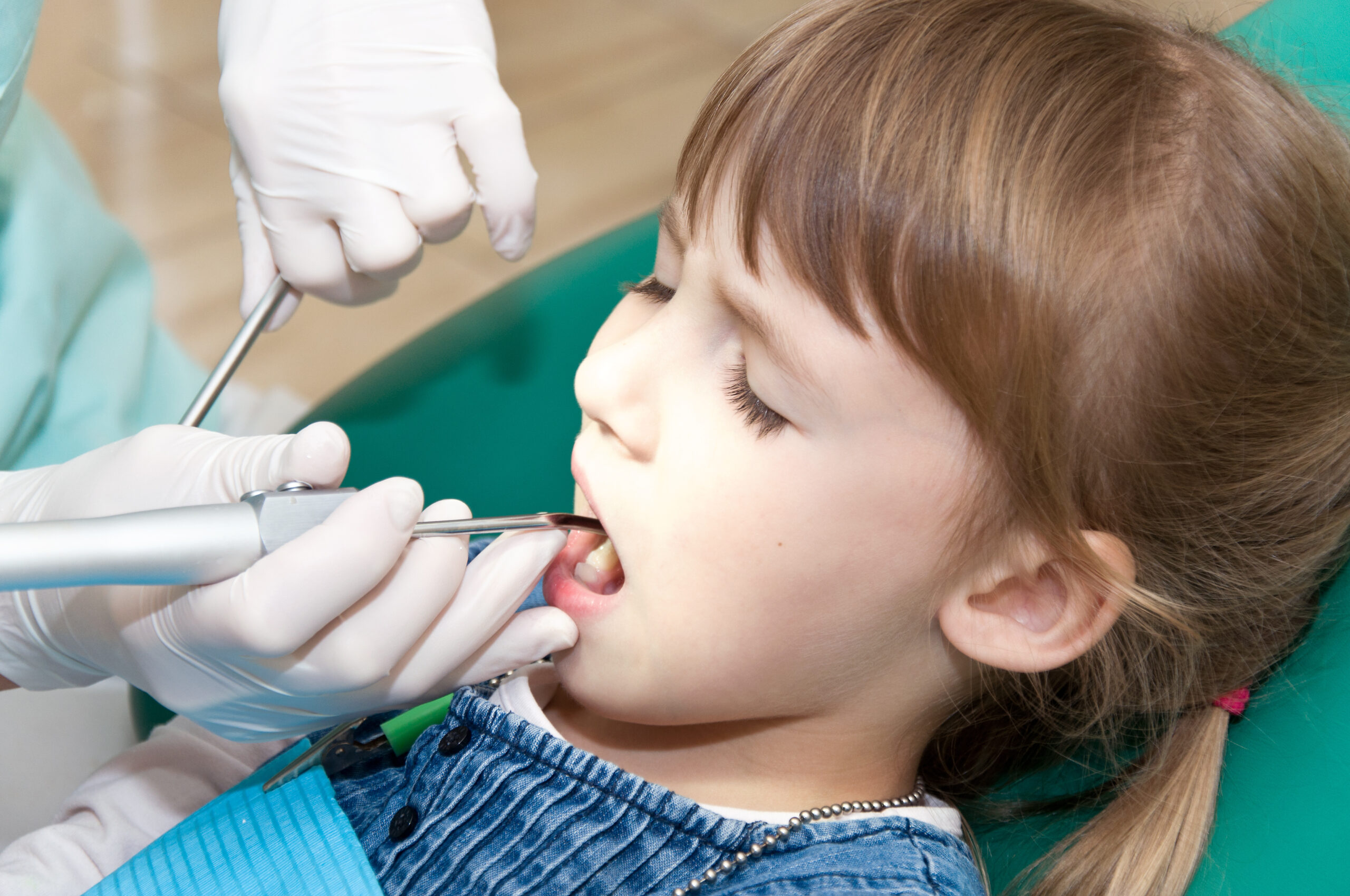 Vitamin D deficiency and tooth decay in children
