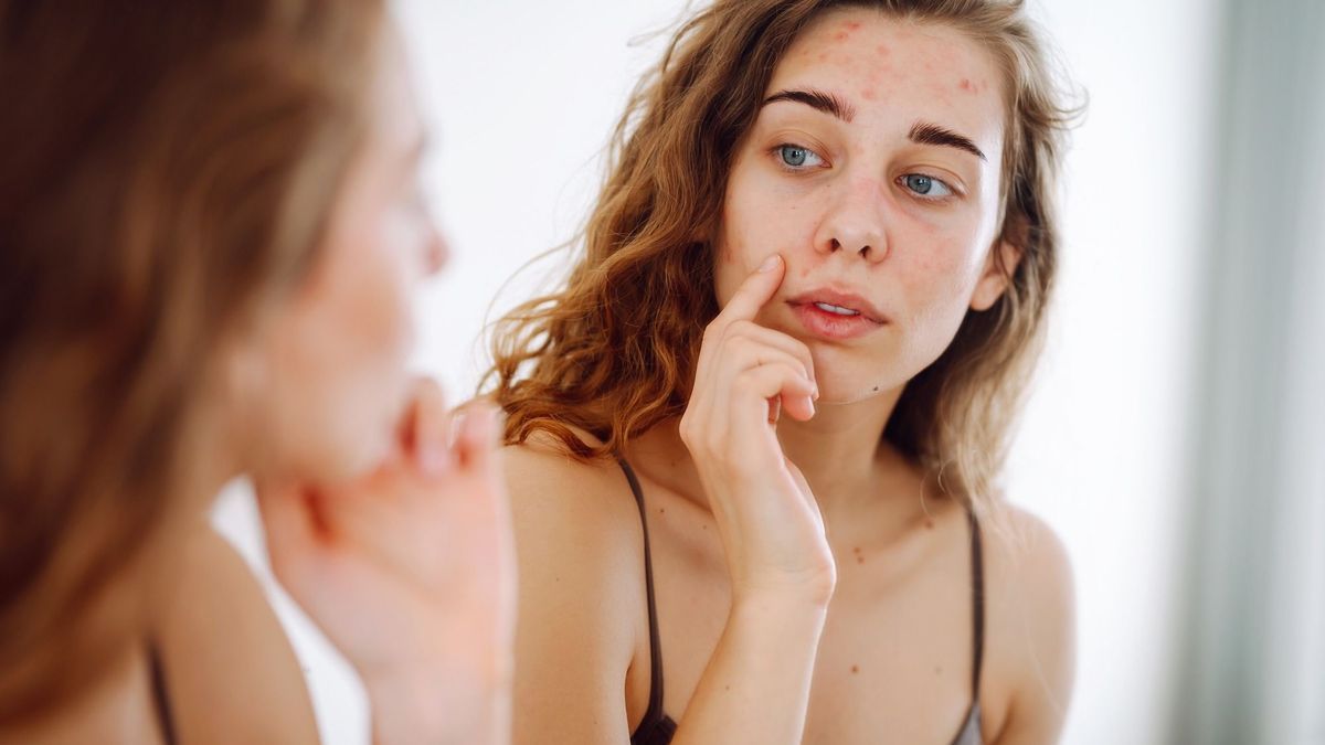 Alert: carcinogenic substances found in our anti-acne treatments