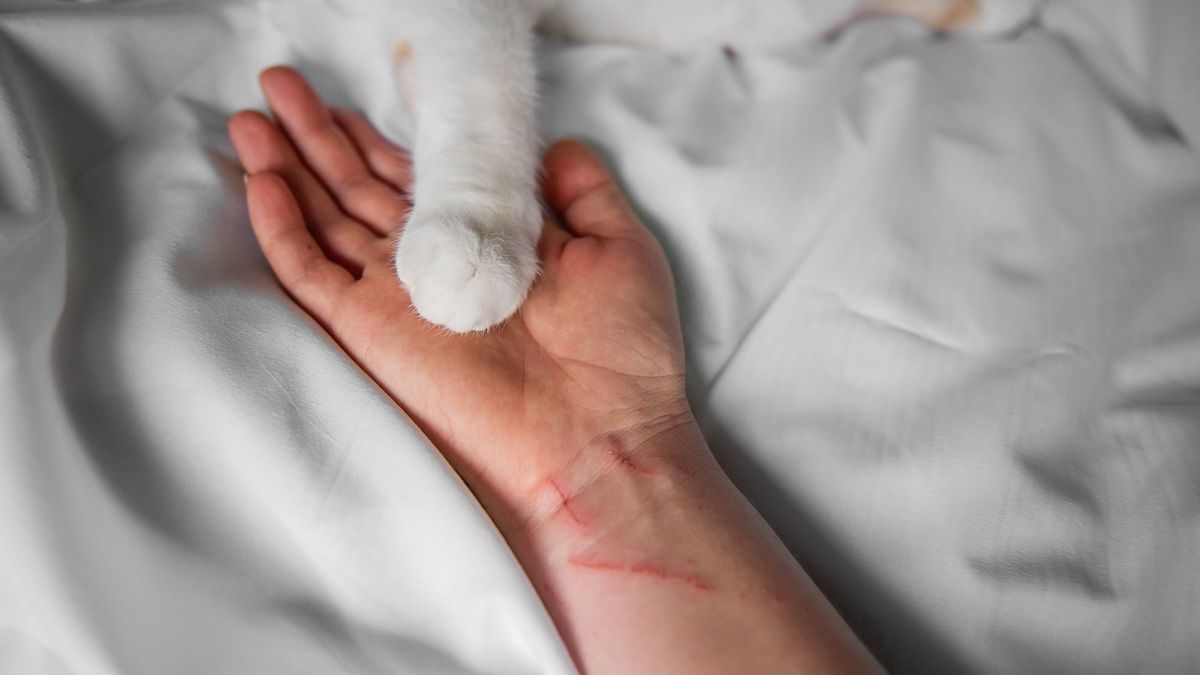 Cat scratch disease