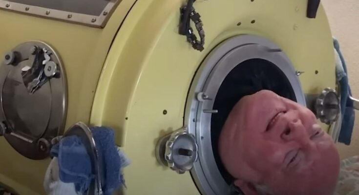 He lived in “an iron lung” for 72 years, discover the video of Paul Alexander who died at 78