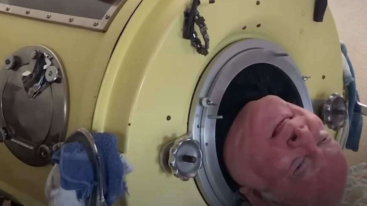 He lived in “an iron lung” for 72 years, discover the video of Paul Alexander who died at 78
