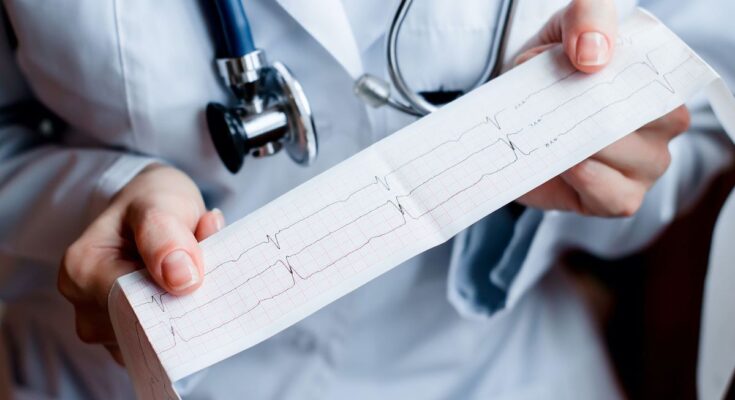 Screening for atrial fibrillation directly with your GP could reduce the risk of stroke