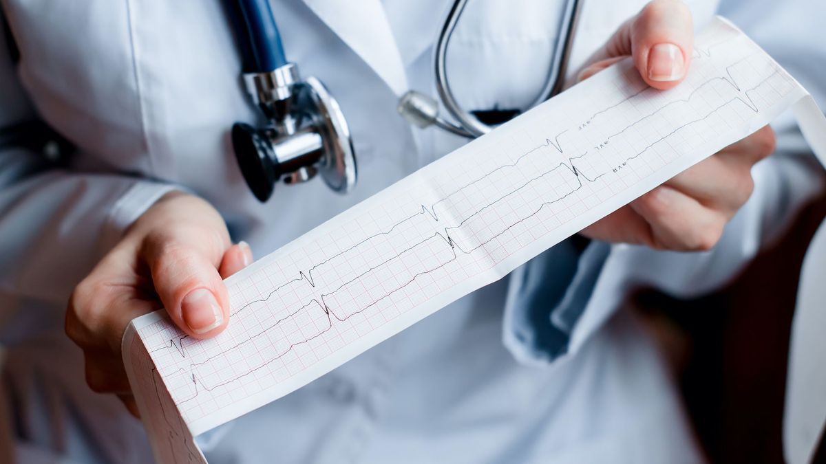 Screening for atrial fibrillation directly with your GP could reduce the risk of stroke