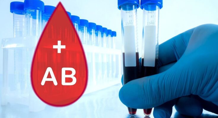 Blood group AB+ (positive) or AB- (negative): definition, differences and distribution